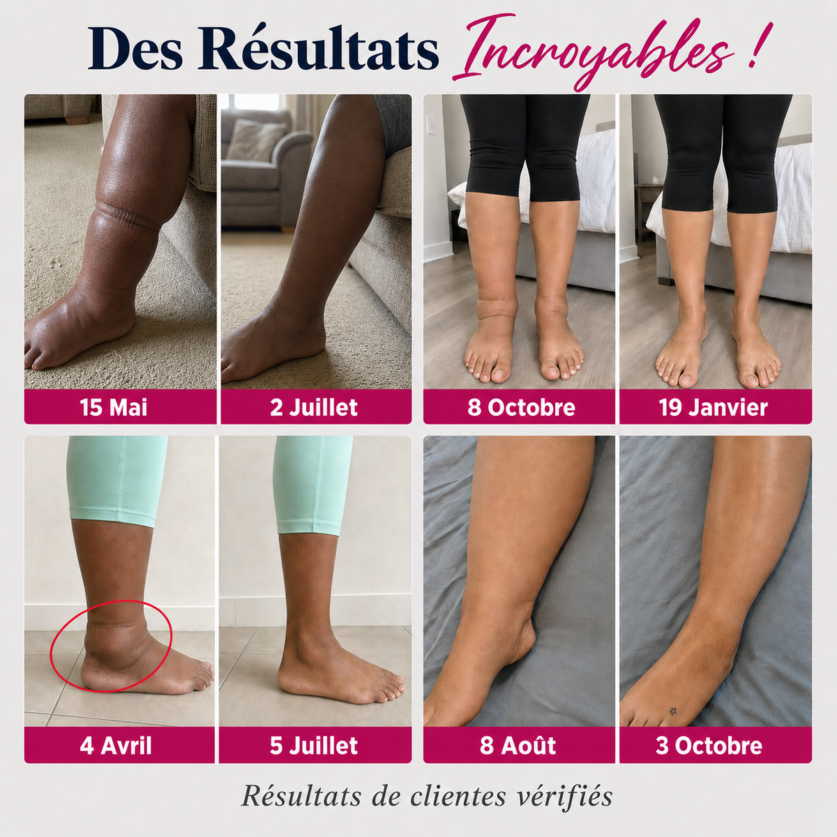 Leggings 3D SunnFit ™ (2 Achetés + 1 Gratuit) - JL