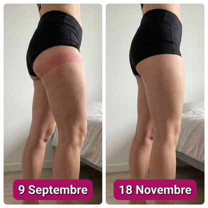 LI-04-hanches-cuisses