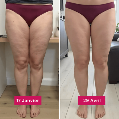 Leggings 3D SunnFit™ (2 Achetés + 1 Gratuit)