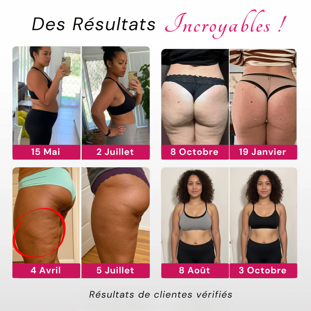 Leggings 3D SunnFit™ (2 Achetés + 1 Gratuit)