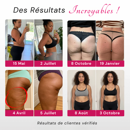 Leggings 3D SunnFit™ (2 Achetés + 1 Gratuit)